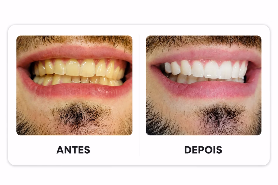 02_antes_depois_sorriso_masculino
